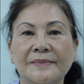 cosmetic surgery