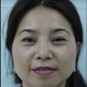 cosmetic surgery
