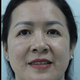 cosmetic surgery