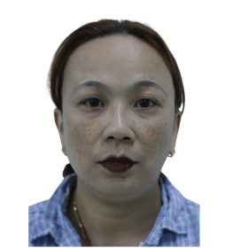 cosmetic surgery