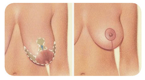 affordable cosmetic surgery