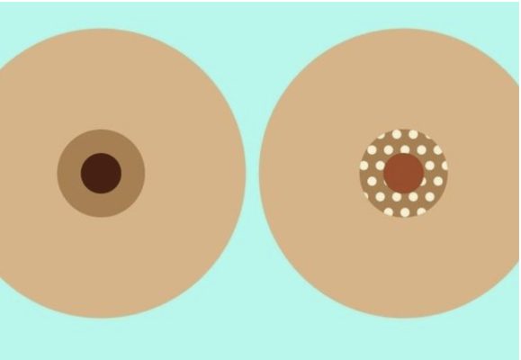 affordable cosmetic surgery
