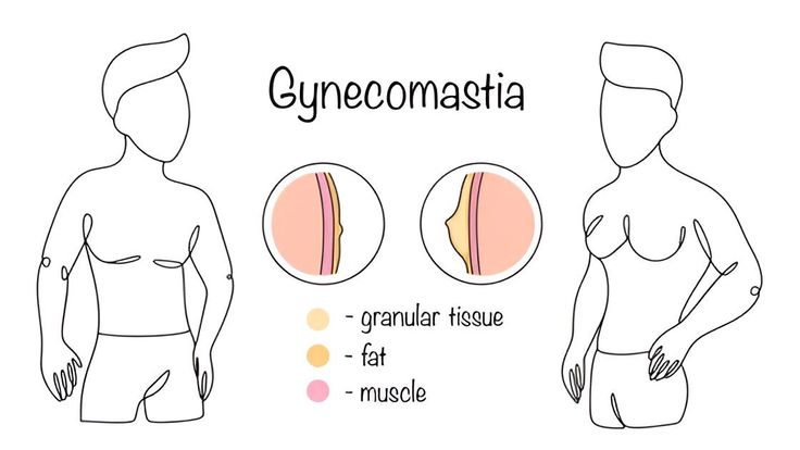Gynecomastia Surgery Vietnam, Male Breast Reduction Ho Chi Minh City, Dr.Phuc Dinh, Board-qualified plastic surgeon